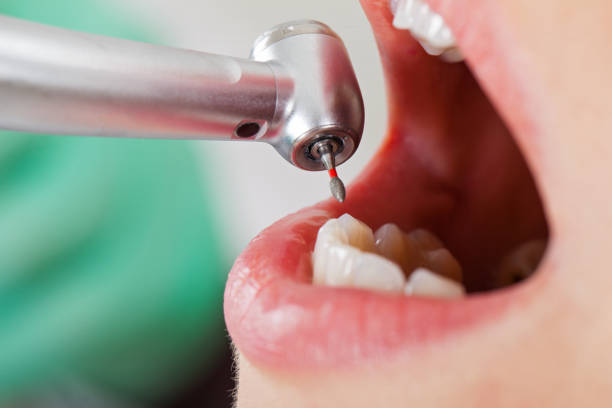 Best Cosmetic Emergency Dentistry in Greenup, KY